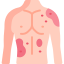 Allergies