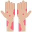 Autoimmune Diseases